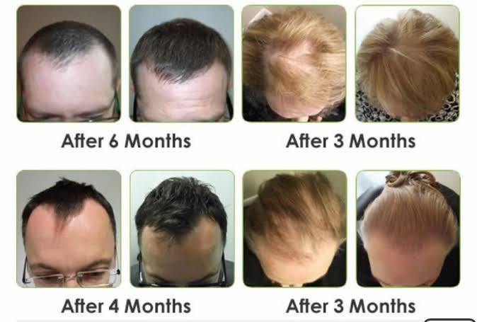 KAMINOMOTO - Hair Growth Trigger
