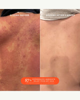 TOWER28 SOS Daily Rescue Facial Spray