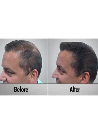 KAMINOMOTO - Hair Growth Trigger