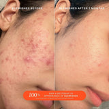 TOWER28 SOS Daily Rescue Facial Spray