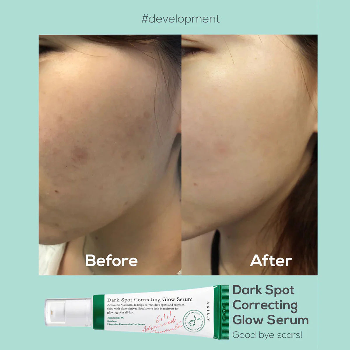 AXIS - Y - DARK SPOT CORRECTING GLOW SERUM 50ml