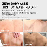MEDICUBE - RED ACNE BODY PEELING SHOT 110g
