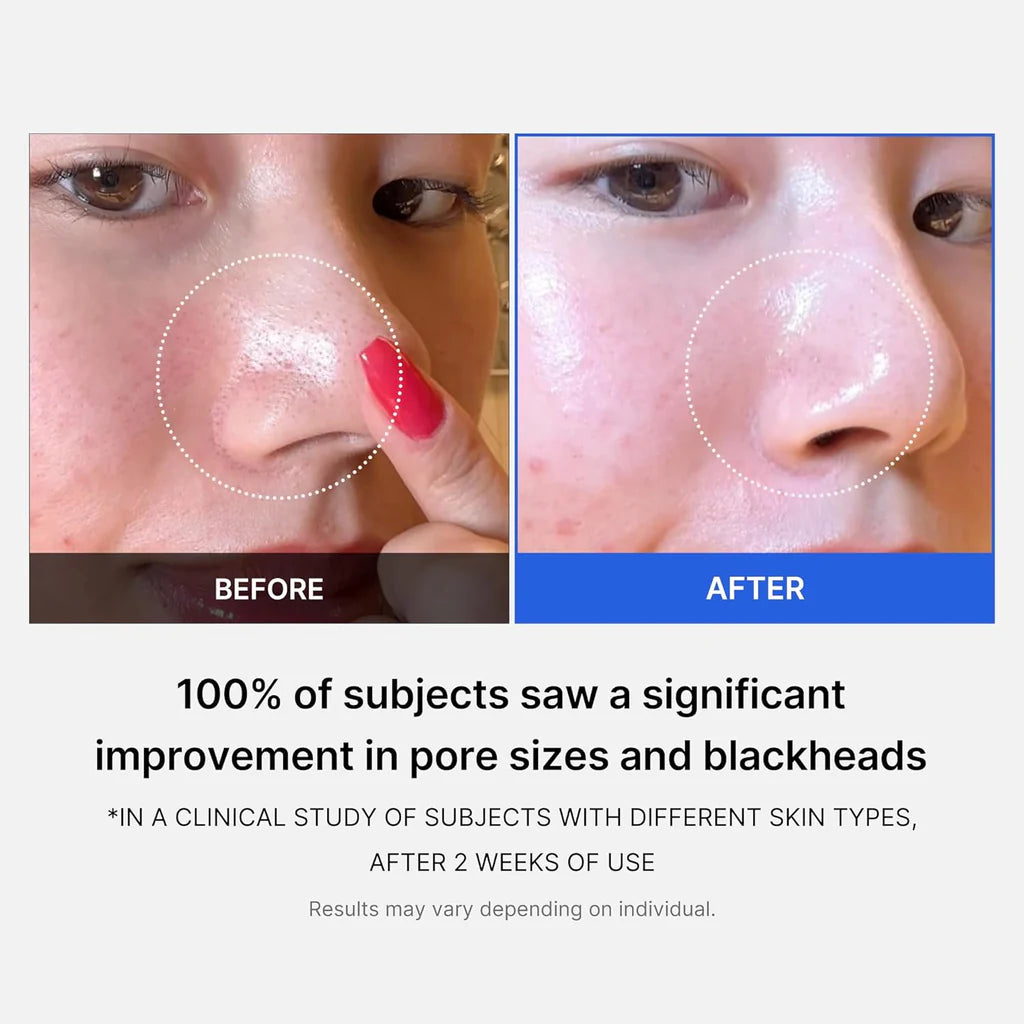 Medicube Zero Pore PAD - 155g