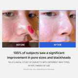 Medicube Zero Pore PAD - 155g
