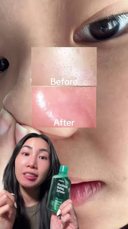 The Jumiso Blackhead Melting Softener