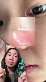 The Jumiso Blackhead Melting Softener