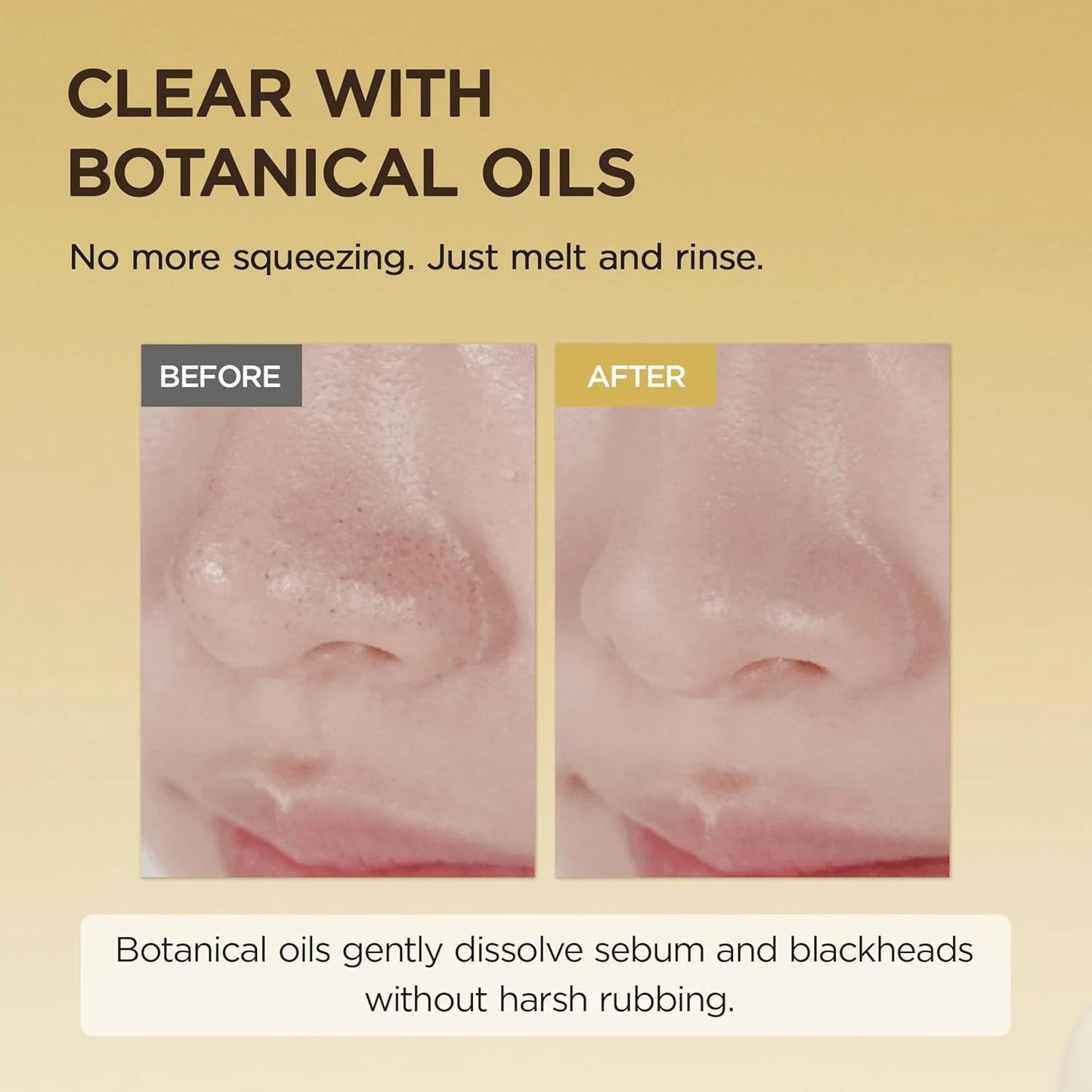 SKIN1004 - Madagascar Centella Light Cleansing Oil Mini