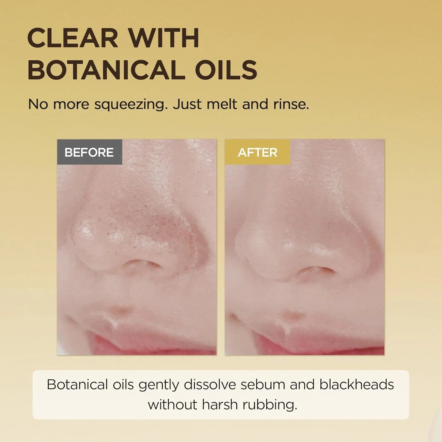 SKIN1004 - Madagascar Centella Light Cleansing Oil Mini