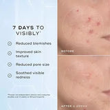 SKIN1004 - Madagascar Centella Niacinamide 10 Boosting Shot Ampoule