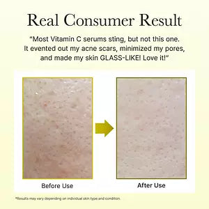 Arencia Vitamin C Booster Skin Brightening and Anti-Wrinkle Injection – 30ml